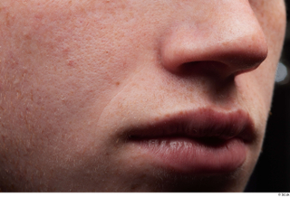 HD Face Skin Fergal cheek face lips mouth nose skin…